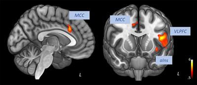 The Influence of Heart Rate Variability Biofeedback on Cardiac Regulation and Functional Brain Connectivity